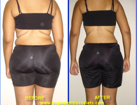 hcg weight loss before and after photos
