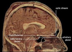 hcg hypothalamus