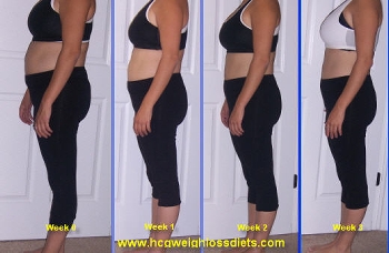 hcg diet before and after pics