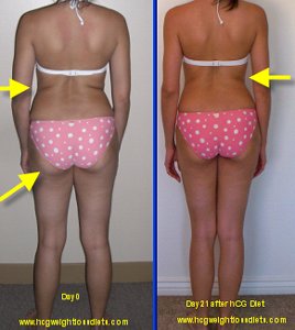 resultados de fórmula hCg oral en adelgazar mujeres con gordura acumulada