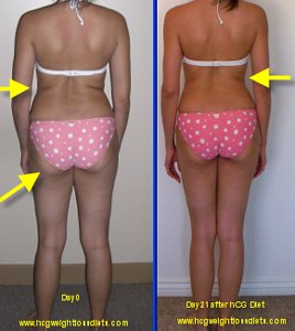 hcg diet testimonials, hCG photo diet testimonial