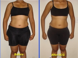 hcg results