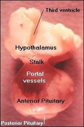 hcg hypothalamus