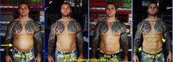 hcg weight loss before and after photos