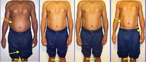 hcg pictures before after pictures